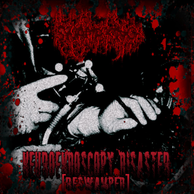 Neuroendoscopy Disaster