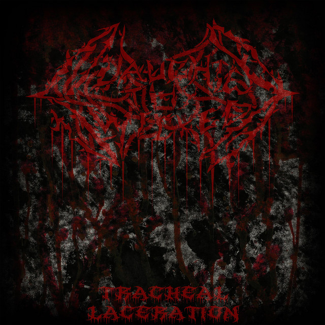 Tracheal Laceration