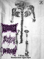 Vitiation / Hepatic Lichens Planus / Ghostslug SPLIT