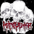 Articulator