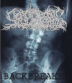 Backbreaker